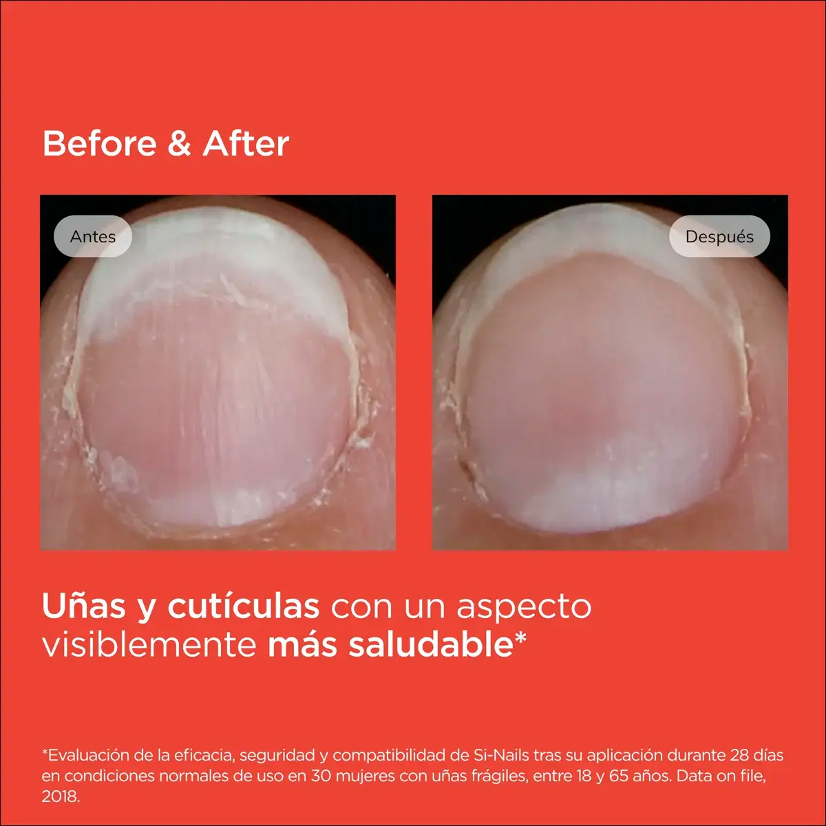 Isdin Si-nails Fortalecedor De Uñas Click Pen