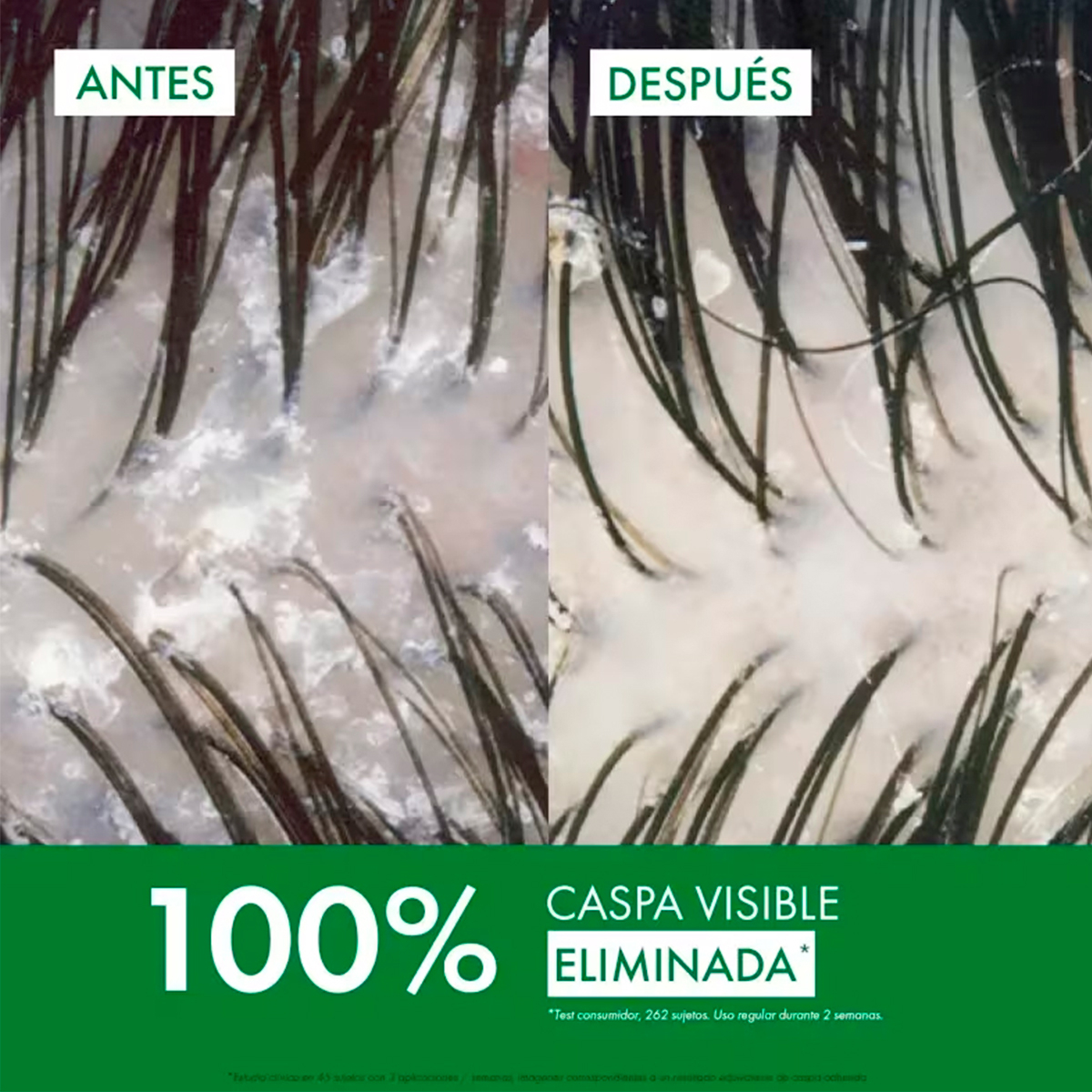 Vichy Dercos Shampoo Anticaspa Normal A Graso X 95ml