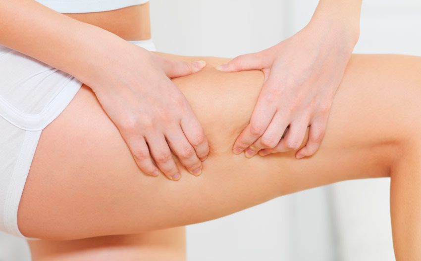 Hábitos saludables para combatir la celulitis
