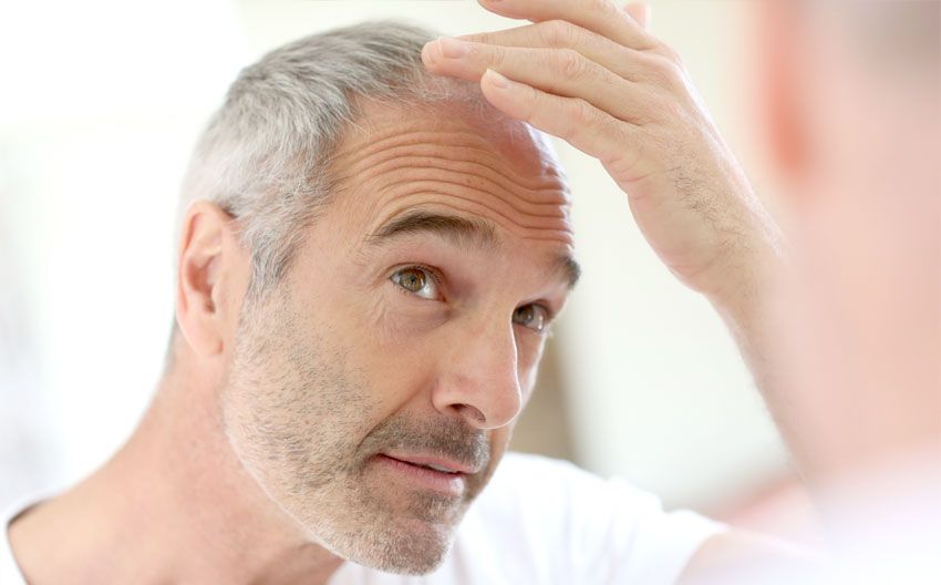 ¿pérdida De Cabello? Motivos Y Soluciones